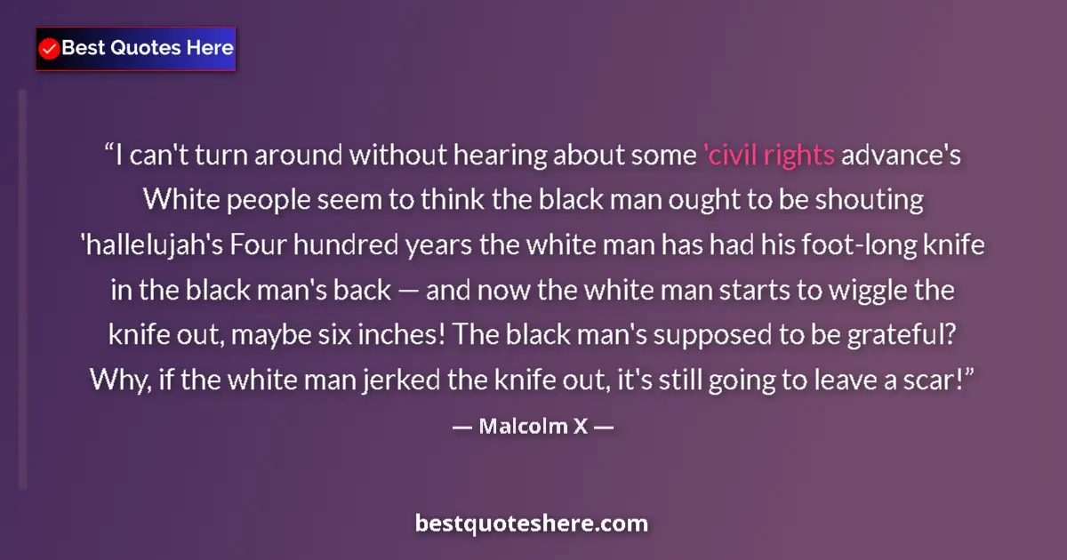 Quote by Malcolm X: I can't turn around without hearing about some 'civil rights advance's White people seem to think th...